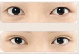 ˫��Ƥ����